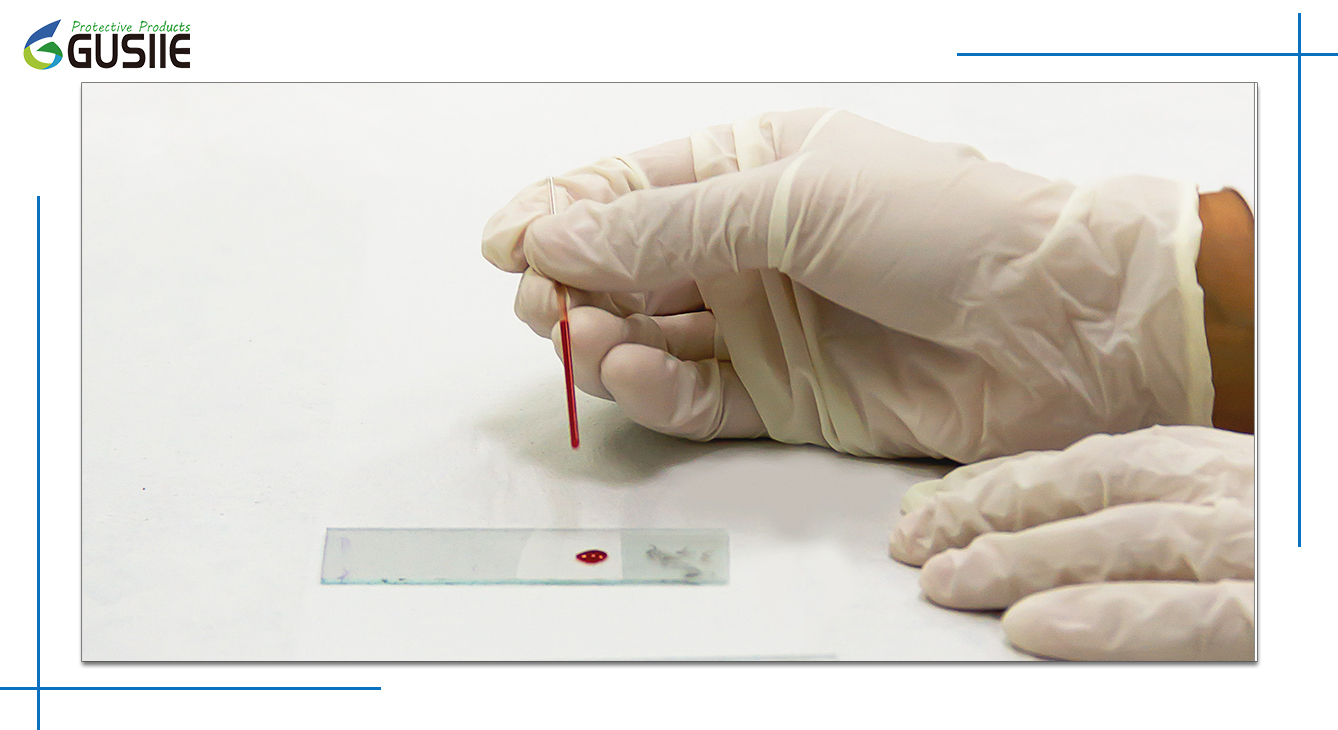 Latex Gloves Turn Yellow Inside at Christopher Trent blog